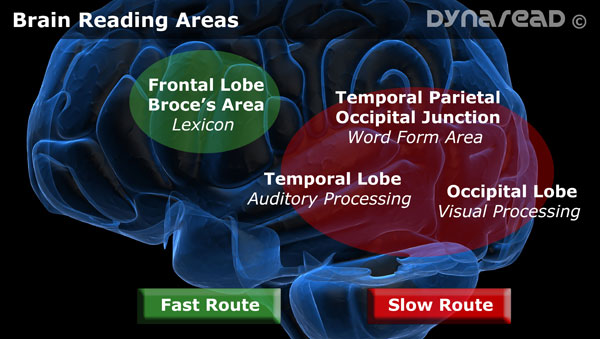 A diagram of the reading areas in the brain